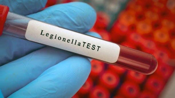 ☣️ Legionierių liga žudo: Niujorke jau trečia auka
Miesto sveikatos departament...